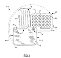 US-8038008-B2 figure 3