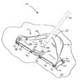 US-8056178-B2 figure 1