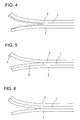 US-8061897-B2 figure 5