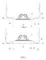 US-8152010-B2 figure 7