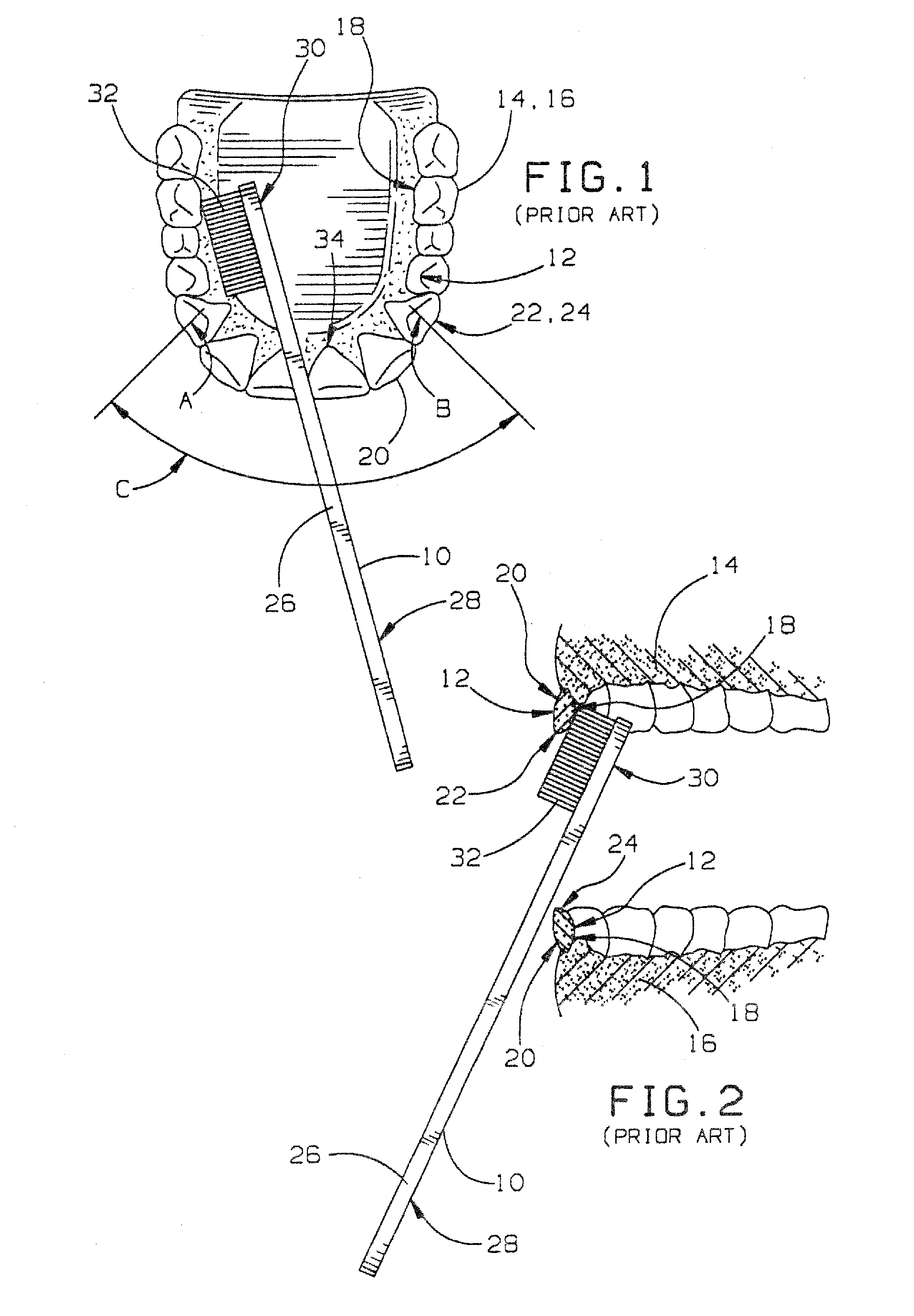 US-8156601-B2 figure 4