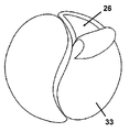 US-8231026-B2 figure 1