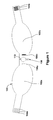 US-8261370-B2 figure 3