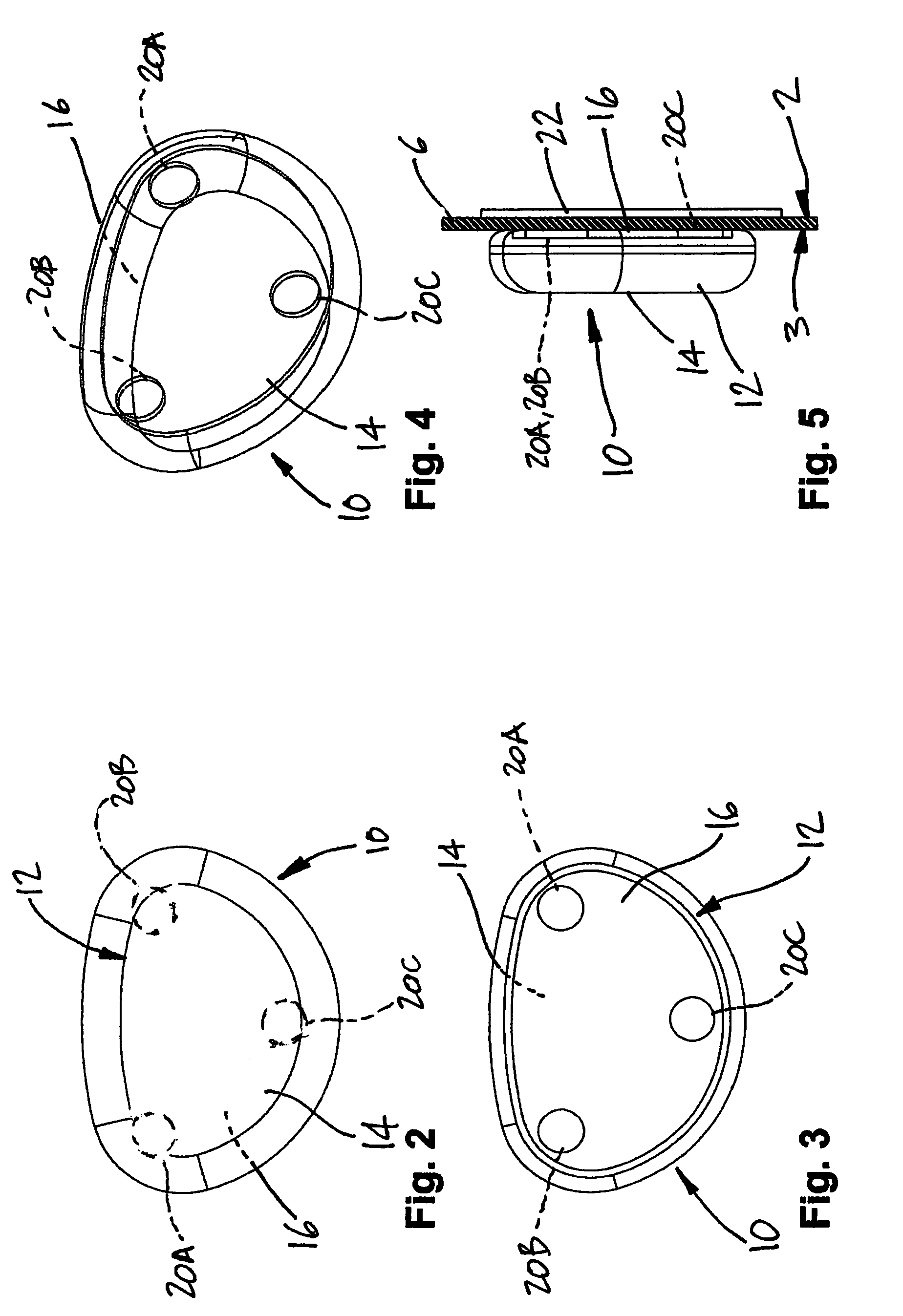 US-8328789-B2 figure 6