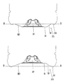 US-8381940-B2 figure 1