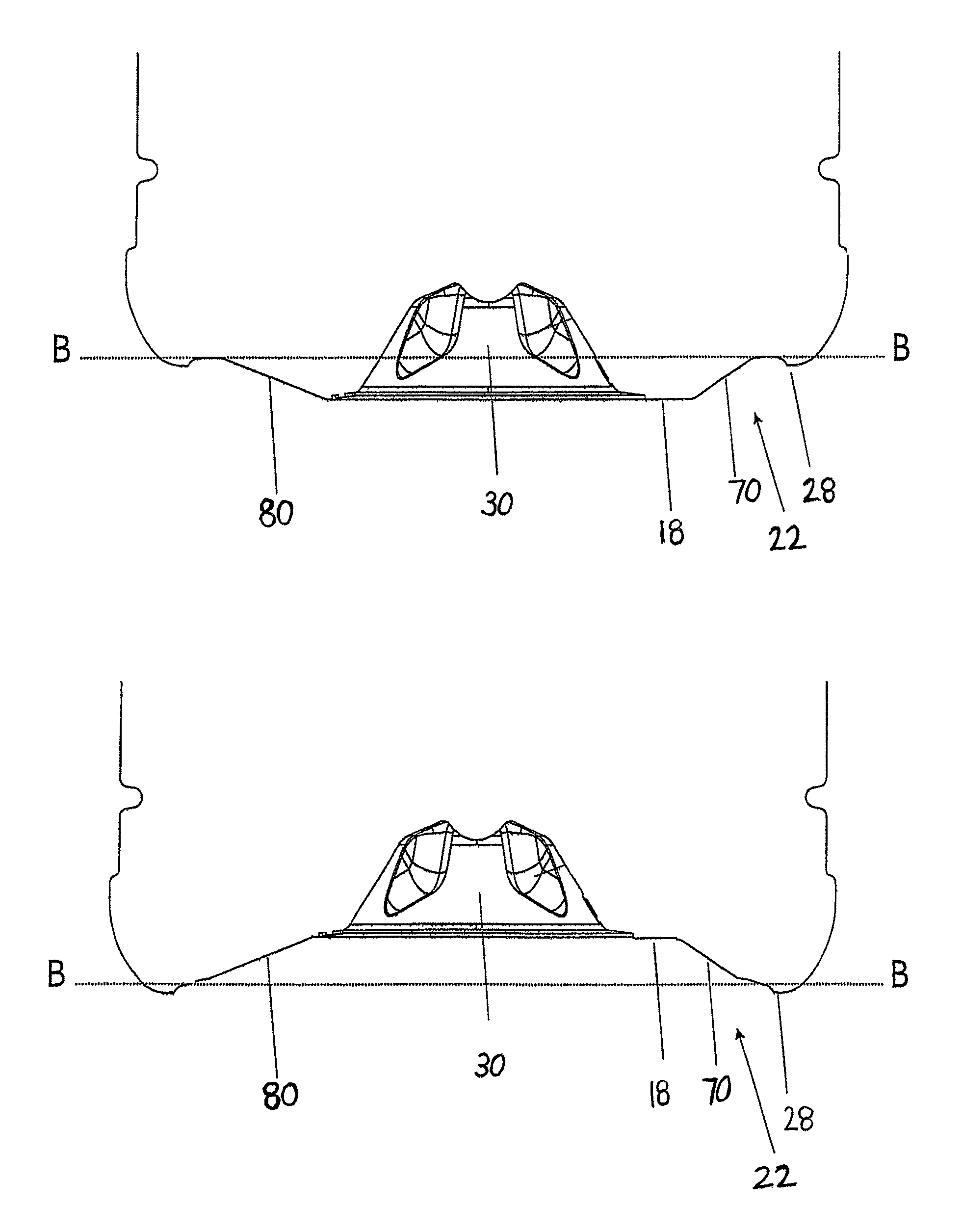 US-8381940-B2 figure 2