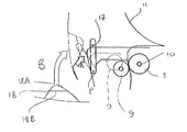 US-8464976-B2 fig 1