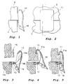 US-8567828-B2 fig 2