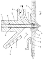 US-8739783-B2 figure 7