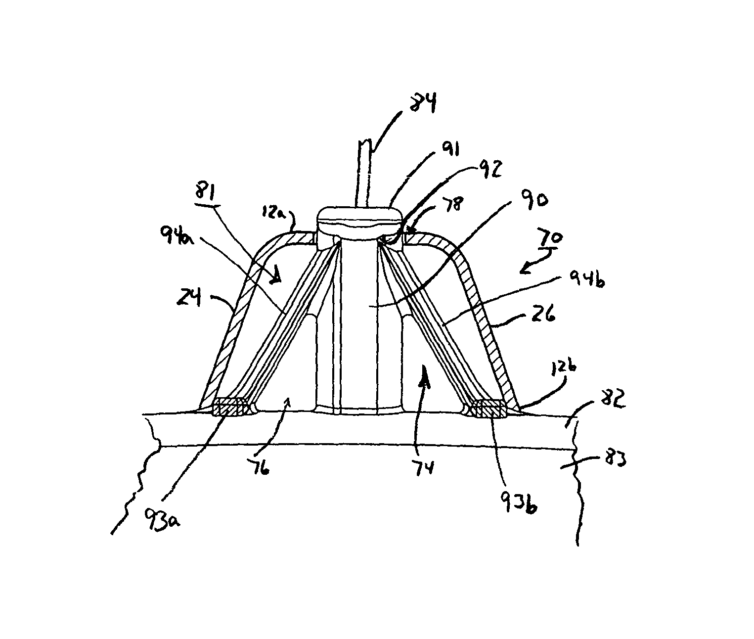 US-9173515-B2 fig 2