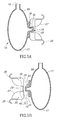 US-9462917-B2 fig 6