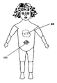 US-9868072-B2 fig 1