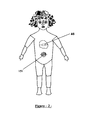 US-9868072-B2 fig 3