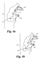 US-9999331-B2 fig 4
